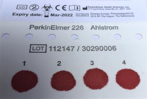 Photo showing a blood spot card. 4 circles of blood have soaked through from the front to the back of the card.