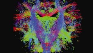 Nerve fibre tracts in a newborn baby's brain, coloured according to which direction the nerve run