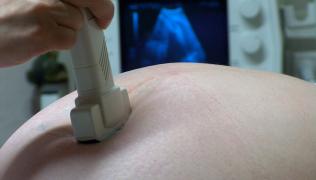 Ultrasound scan