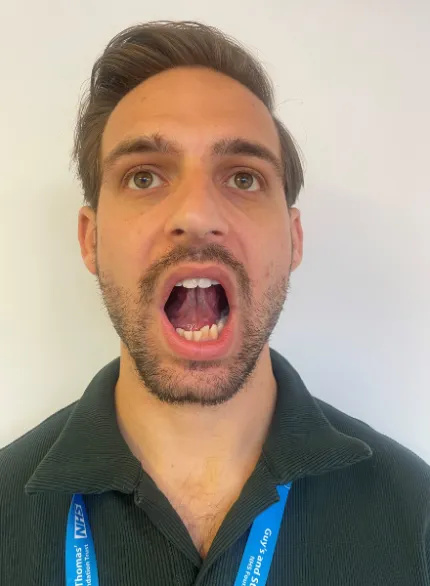 Photo of a man with an upright posture. He is pushing the tip of his tongue into the roof of his mouth and opening the mouth as wide as he can.