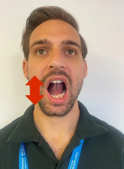 Photo of a man in an upright posture opening his mouth as wide as he can.