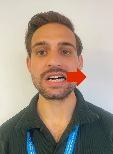 Photo of a man in an upright posture. He has his mouth slightly open and is moving the bottom jaw to the left.