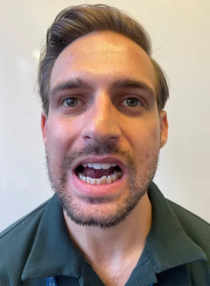 Photo of a man in an upright posture moving his bottom jaw in a clockwise direction. This movement replicates a sideways figure of 8 or camel chewing motion.