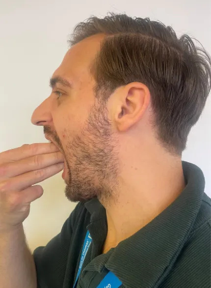 Photo of a man trying to fit 3 fingers stacked vertically between his front teeth or gums.