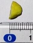 Image shows a small piece of pistachio nut, without the shell, on a flat surface. The pistachio is next to a ruler, showing the nut measures approximately 5mm in length. 