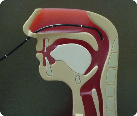 A diagram showing a long thin tube called a nasendoscope going through a model person's nostril. The tube passes backwards until it sits just above the person's soft palate (roof of the mouth) and near the side and back walls of their throat.