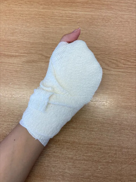 Photo of someone's hand and forearm. A white bandage fully covers their wrist, hand and 4 fingers. Only the person's thumb and upper forearm are uncovered by the bandage.
