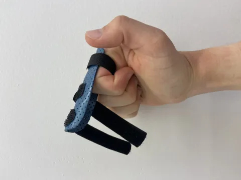 Photo of someone's hand. There is a splint with 3 straps on their index finger and the top 2 straps are undone. The person has bent their index and other fingers into a fist position, while the thumb points upwards.