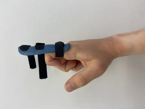 Photo of someone's hand. There is a splint with 3 straps on their index finger and the top 2 straps have been opened. The person has bent their index and other fingers into a "hook" position, while the thumb remains outstretched in its natural position.