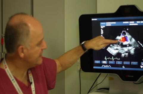 Dr Simpson looks at an echocardiagram